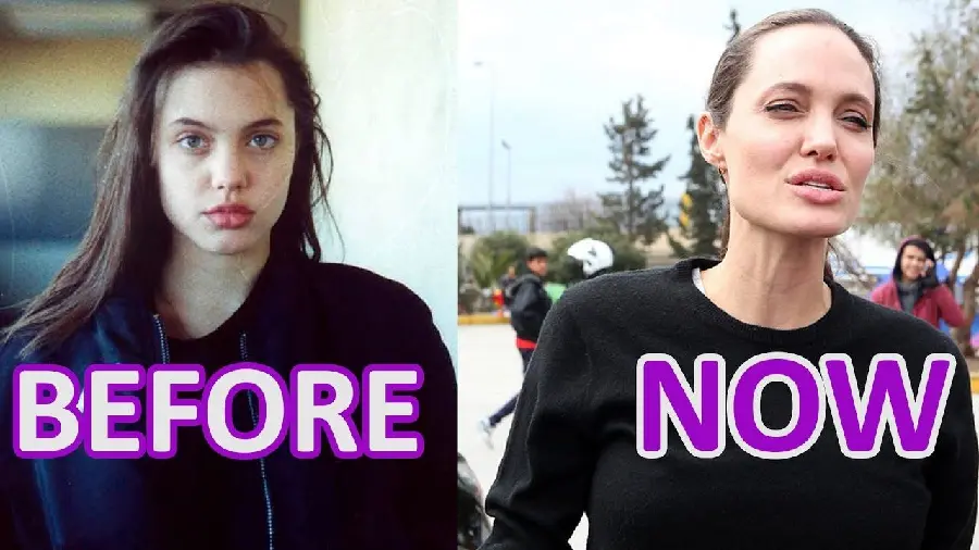 Angelina Jolie Before Cosmetic Surgery Photo for Fans