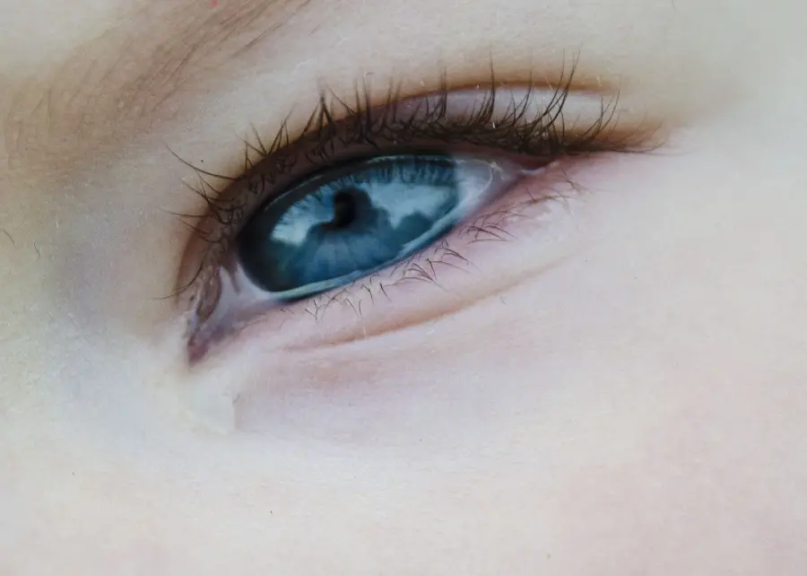 Tearful Eye Picture