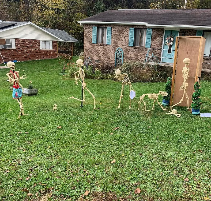 High Quality Realistic Human Skeletons Presentation Photo
