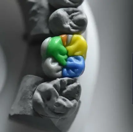World Toothache Day Image for National Toothache Day