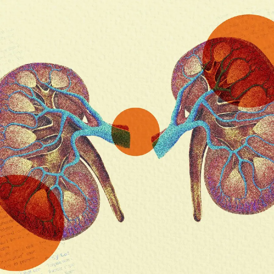 Image of a real human kidney for a profile