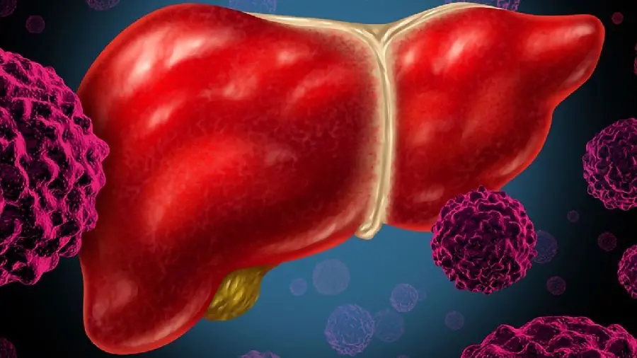 Cartoon and graphic photo of a human liver