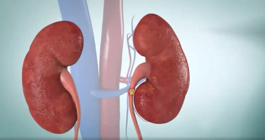 High quality photo of a human kidney