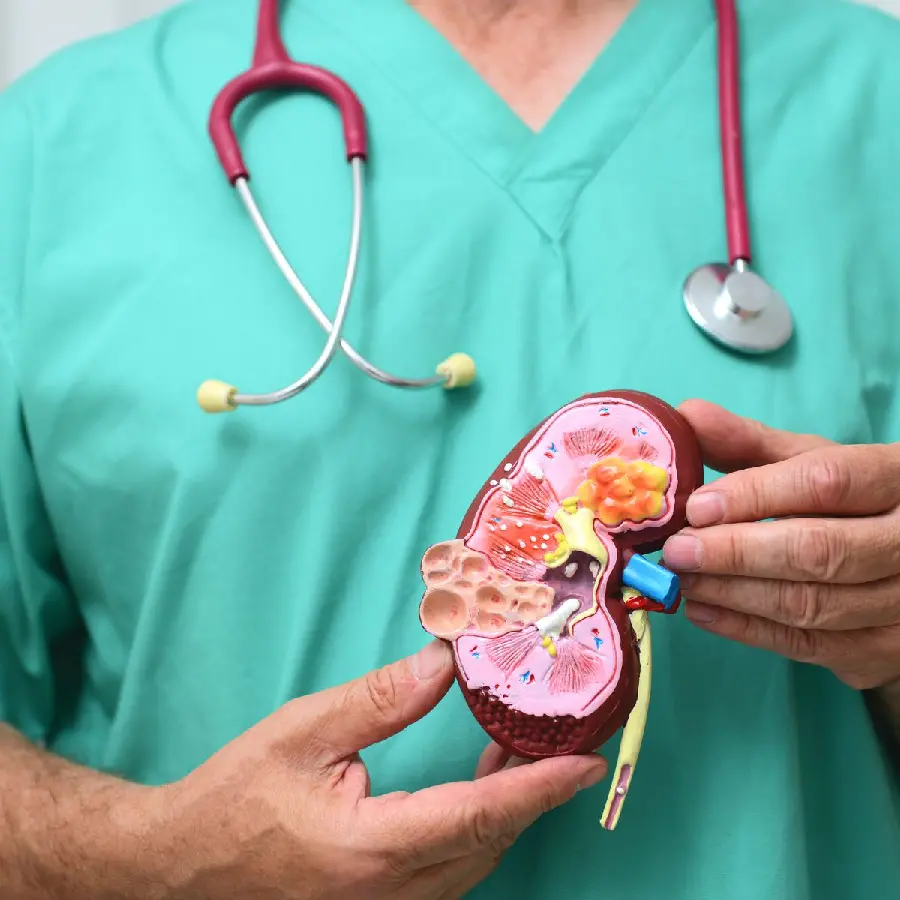 Photo of a human kidney model made by a specialist doctor