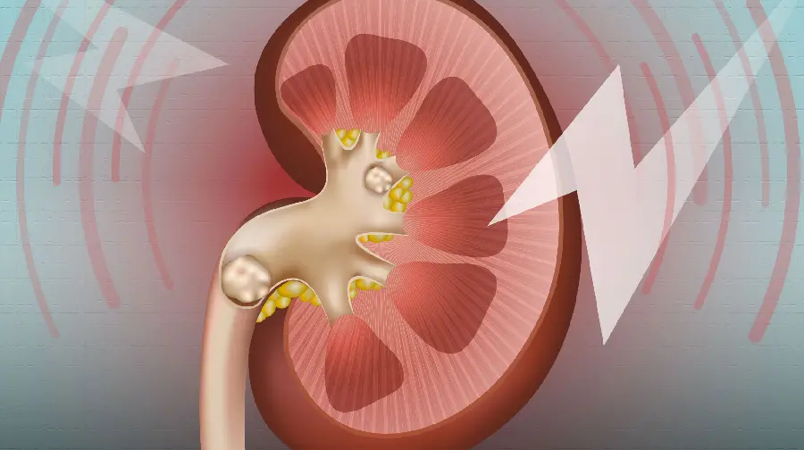 Real Human Kidney Wallpaper for PhD Students' Computer Background