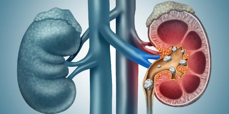 Photo of a human kidney in FULL HD quality