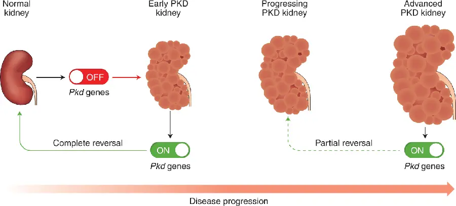 Photo of the real kidney
