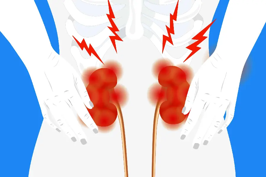 Photo of human kidney and bladder