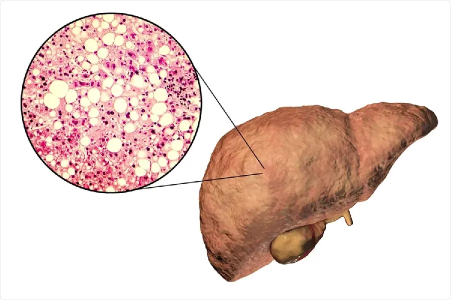 Photo of human liver tissue from a close and interesting view