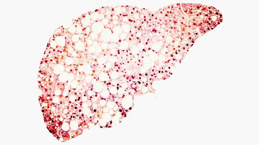 Photo of human liver for computer wallpaper