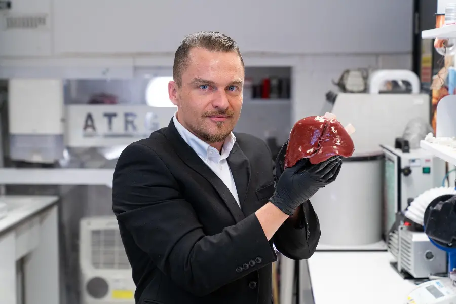 Photo of the liver in the hands of an internal medicine doctor