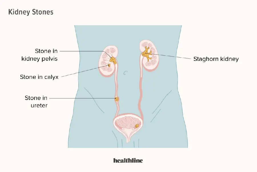 Photo of the kidney and bladder