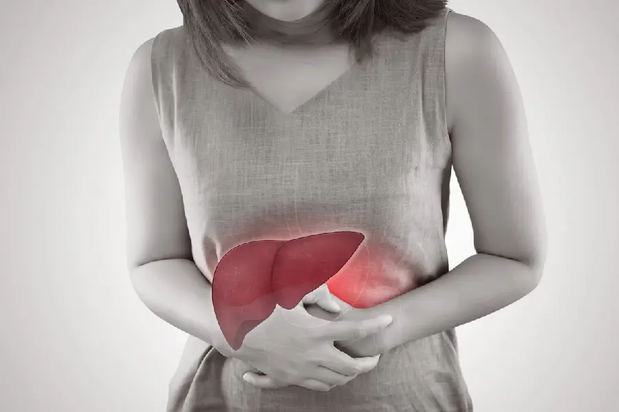 Photo of fatty liver disease in humans