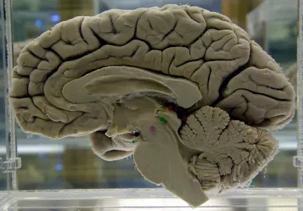 Photo of human brain cut into two halves in water