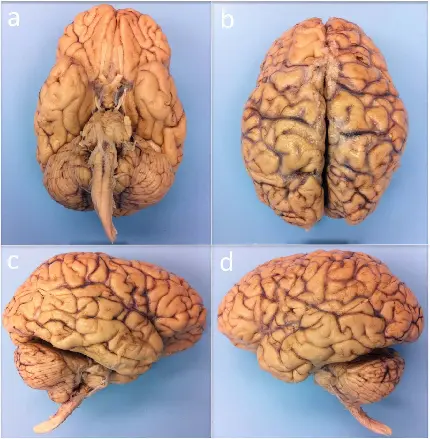 Photo of real human brain