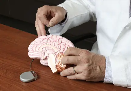 Photo of human brain anatomy