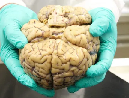 real human brain photo