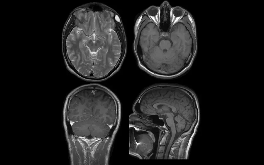 Radiology of different parts of the human head for biological research