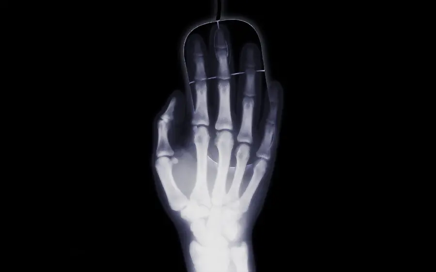Hand Radiology Image on Computer Mouse for Gaming Wallpaper
