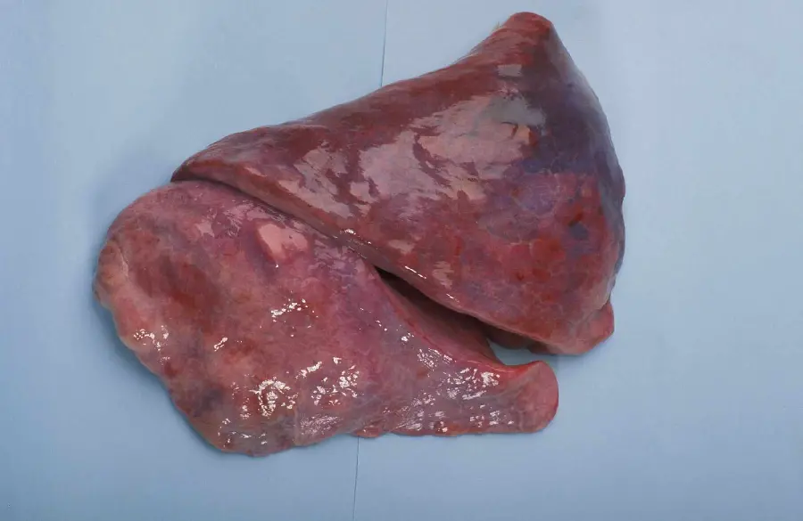 Close-up Photo of a Slice of a Human Lung