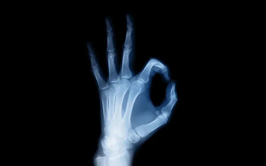 Interesting 3D photo of the left hand radiology with the OK symbol