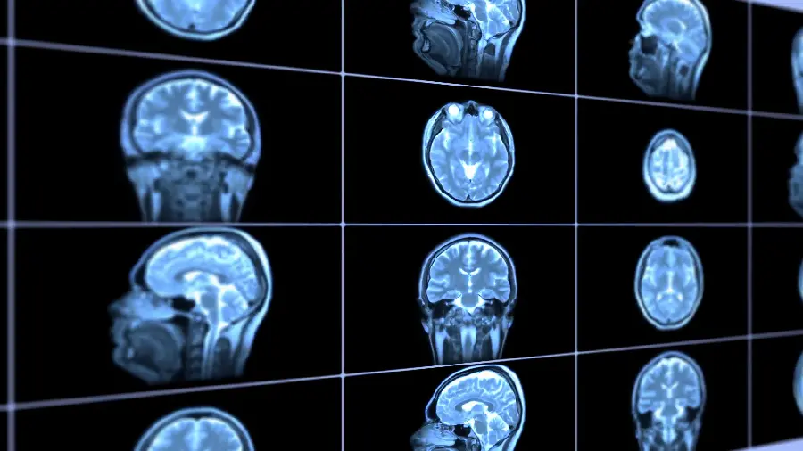 Very beautiful and detailed radiology photo of different parts of the brain