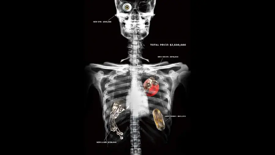 Amazing image of human radiology with artificial limbs