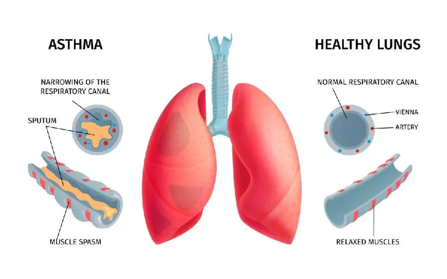 Photo of a healthy lung for essays and articles