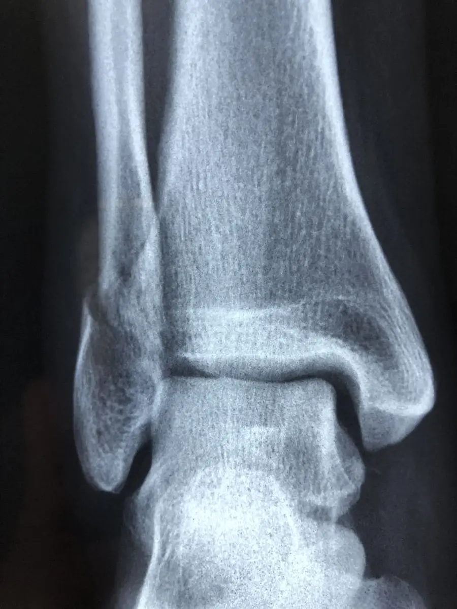 HD stock photo of detailed radiology for medical students