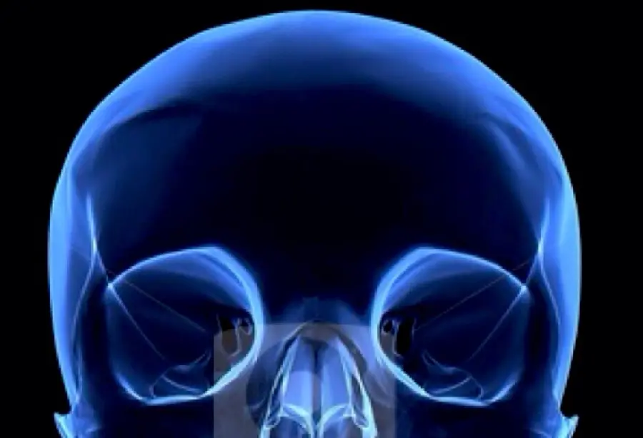 Free download of Digital Radiography of the eye from the opposite angle