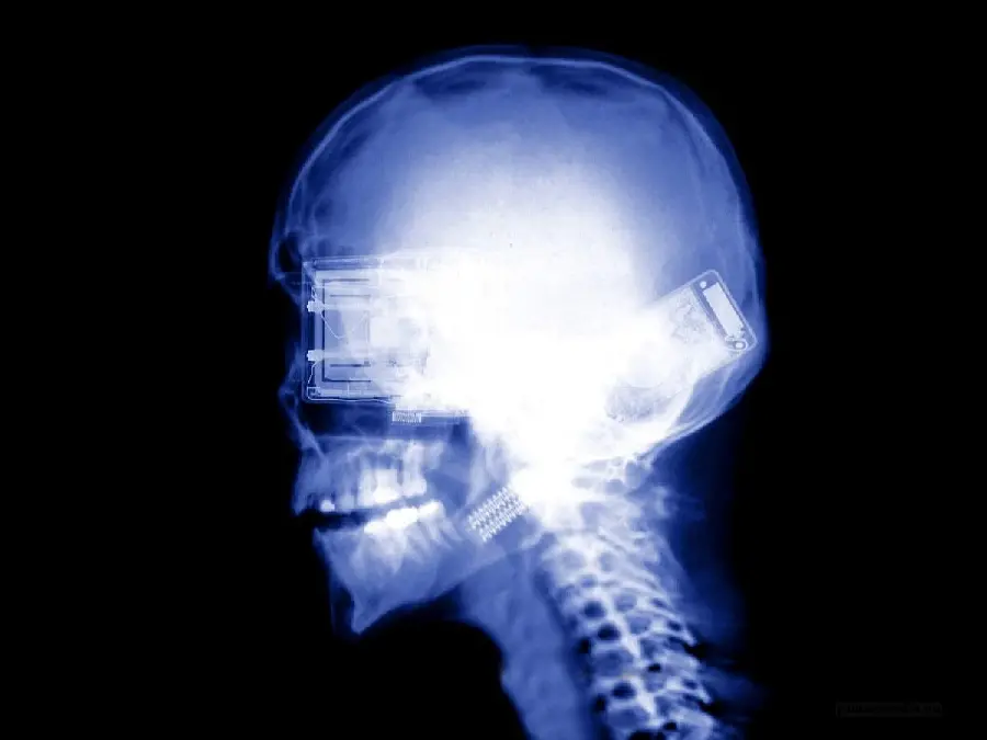 The most interesting photo Radiology of the head and neck in special quality