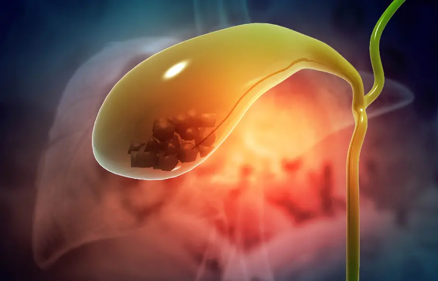 Gallbladder