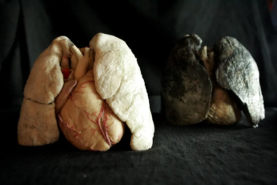 Photo of the human lung of a smoker and a non-smoker side by side