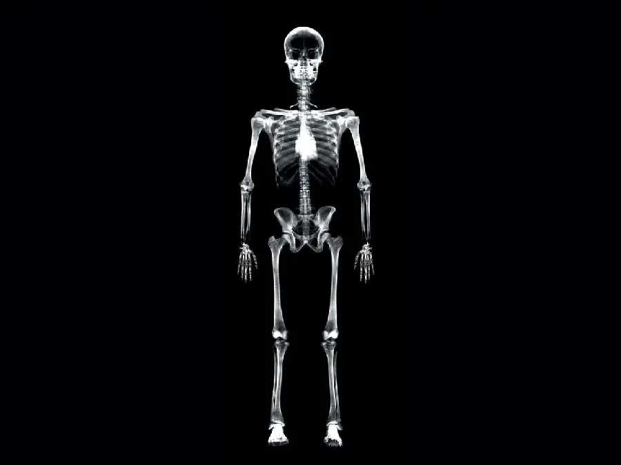 Full Body Human Radiology Image with Original Quality 1401