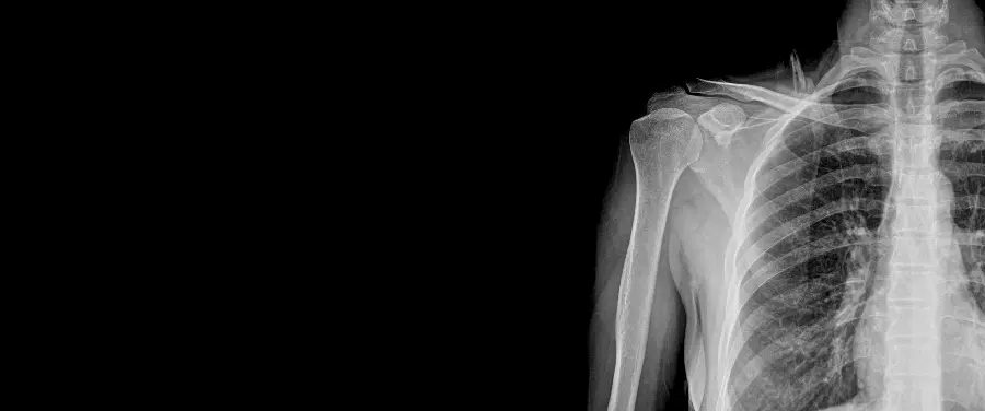 Best Raw Photo with Black Background for Radiology Card Printing