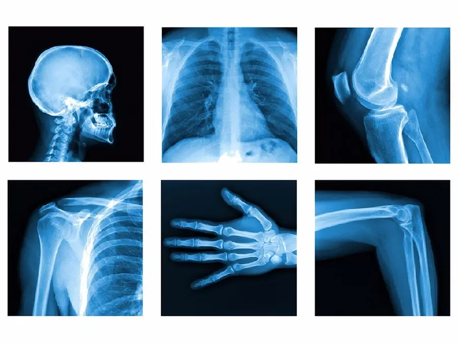 Radiology images of different parts of the body with quality twenty
