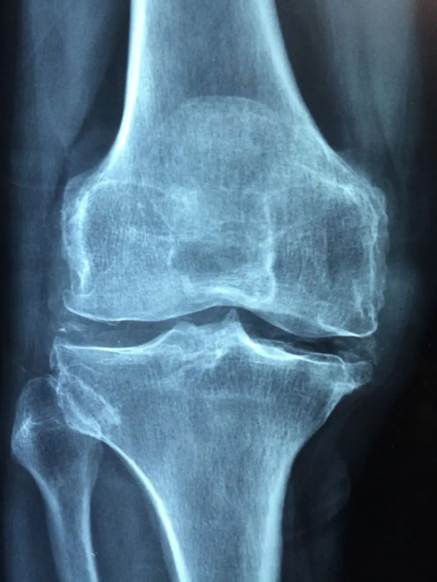 The most downloaded radiology image of the joint in Full HD quality