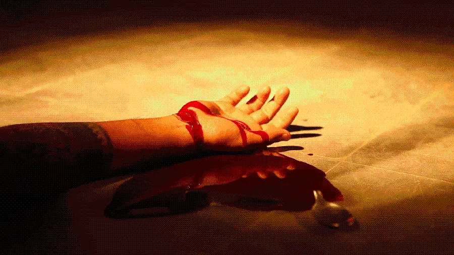 Download real and HD photo of bloody hand with torn vein 