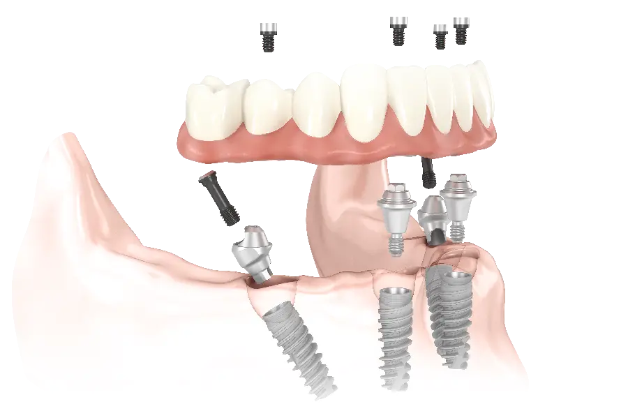 High quality tooth png cutout graphic image