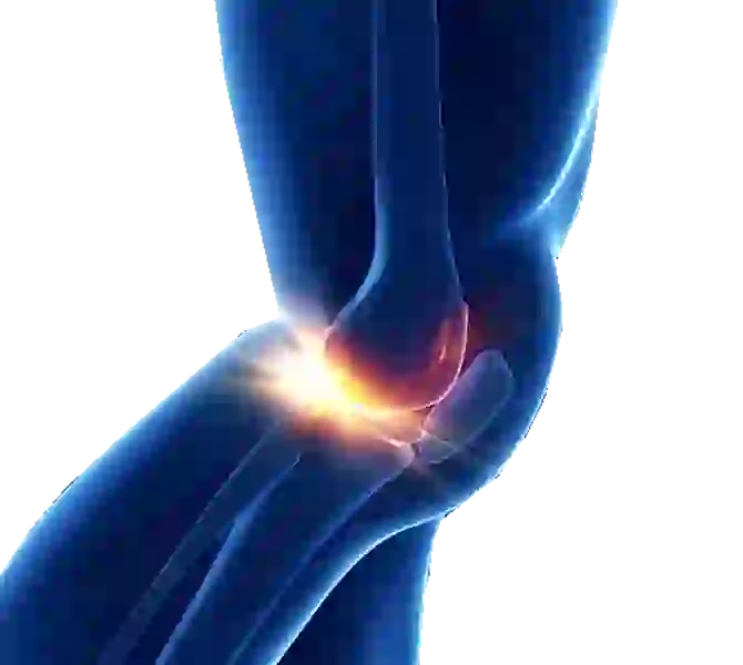 Digital image of the injured knee with the topic of physiotherapy