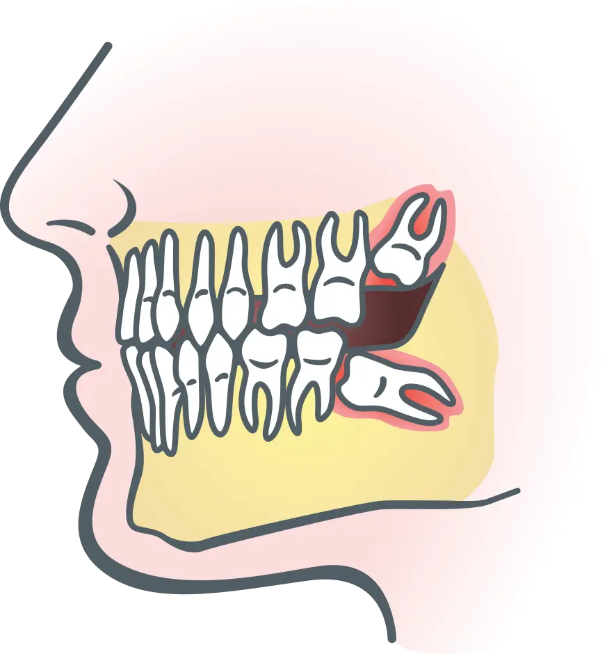 Interesting and Spectacular Computer Graphic Image of Neat and Messy Teeth 