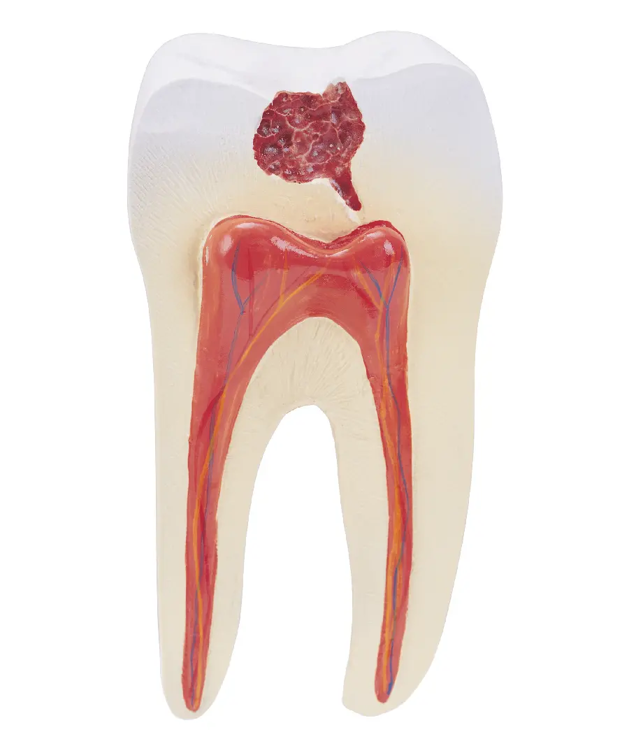 Photo of tooth and tooth root mold with high quality