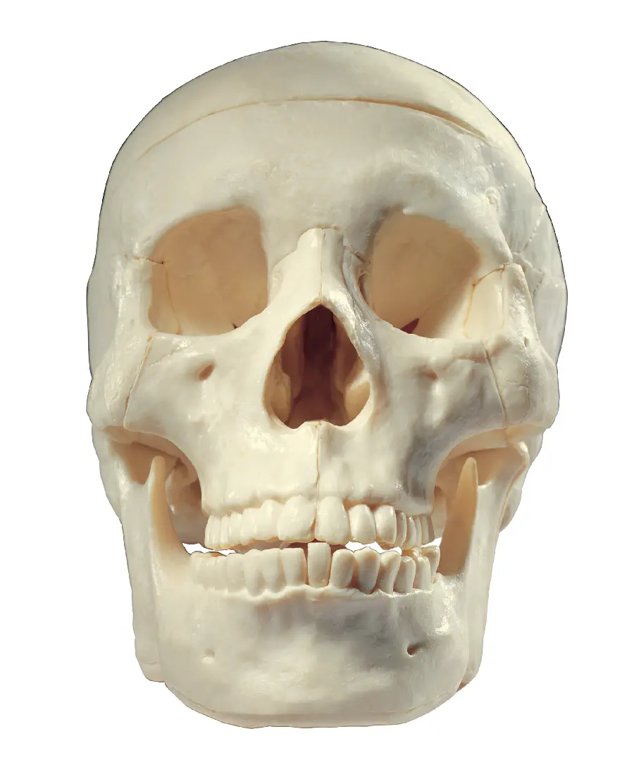 Photo of the skull