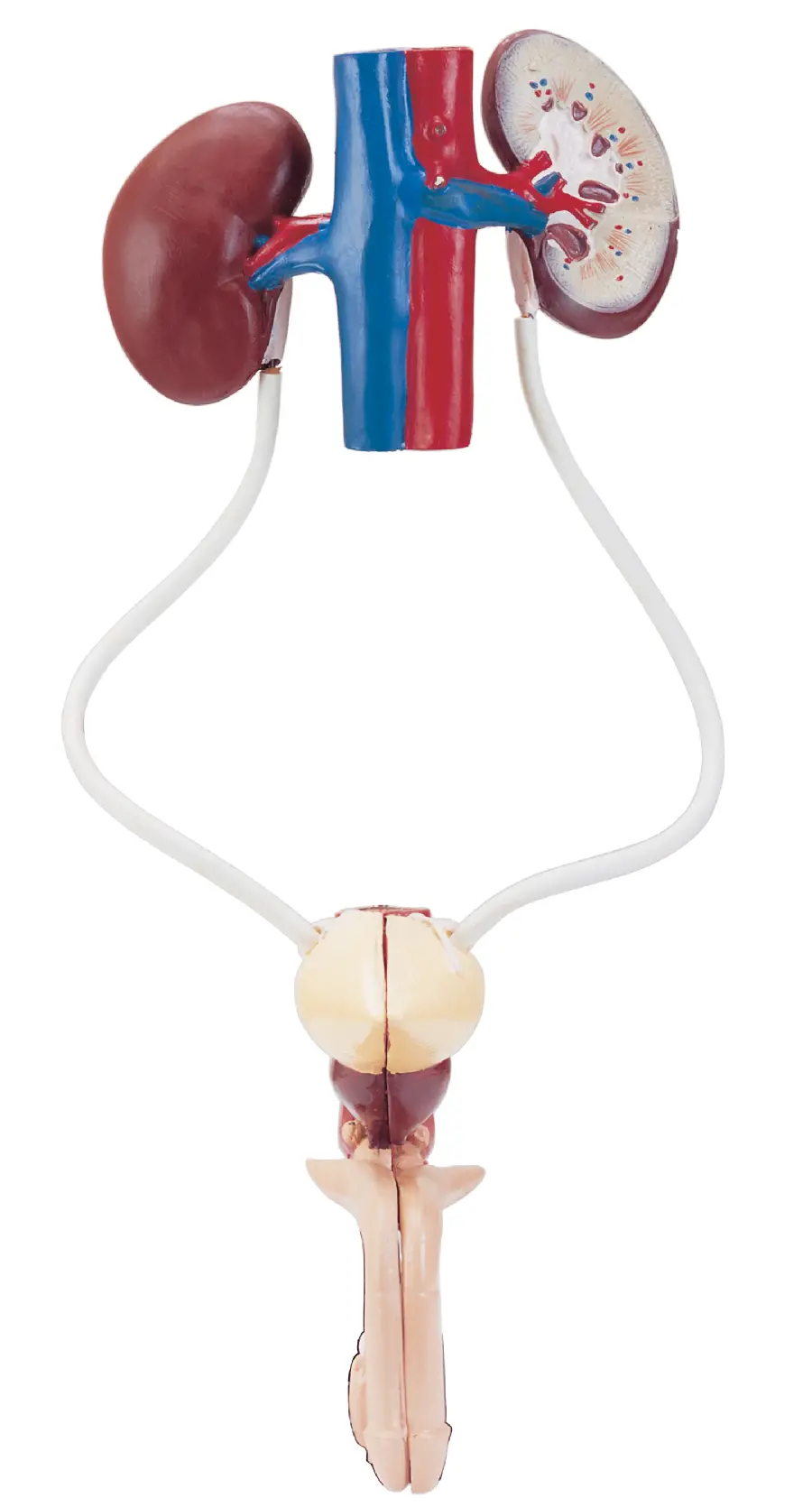 Photo of kidney and urinary tract mold