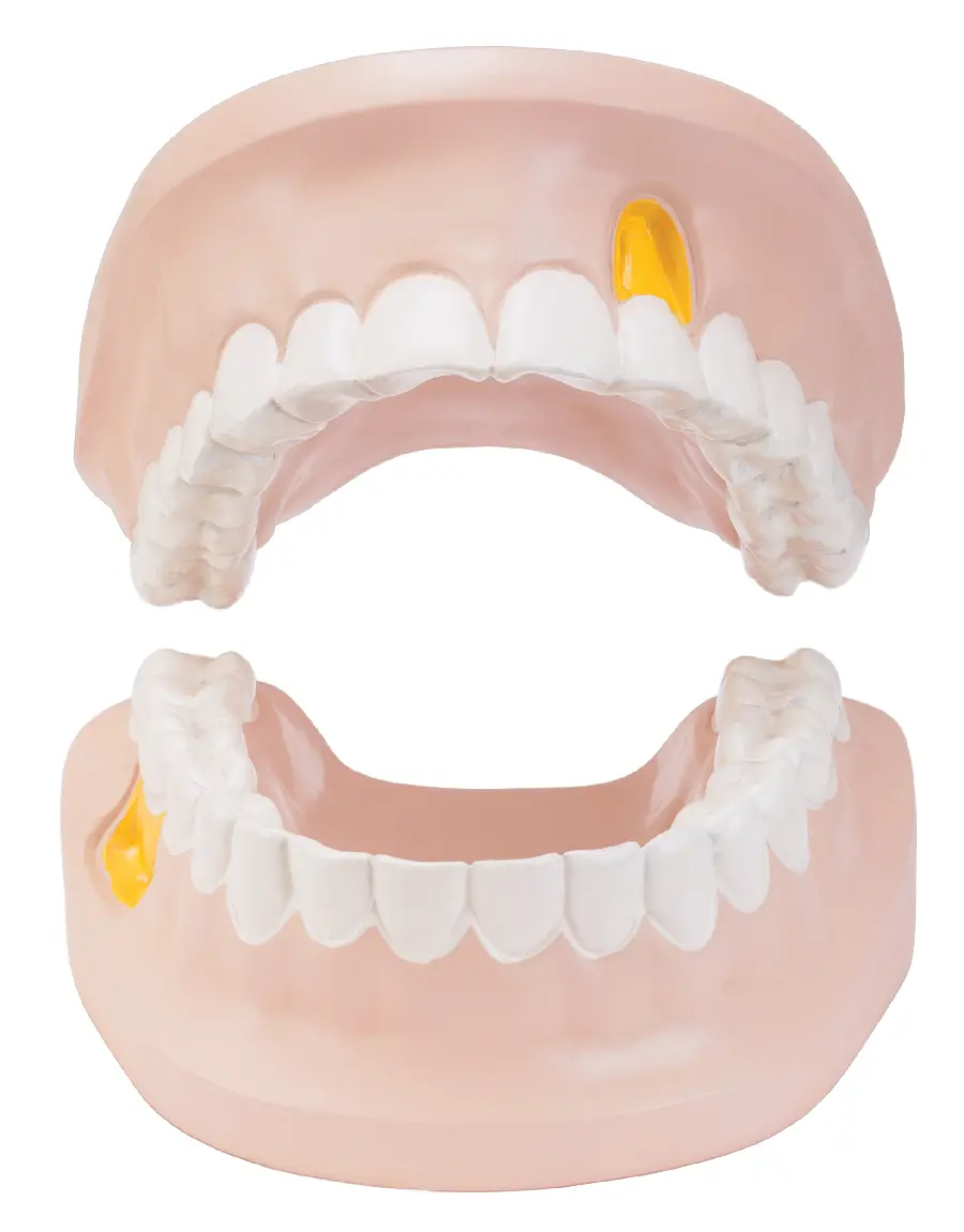 High quality mouth and teeth photo mold