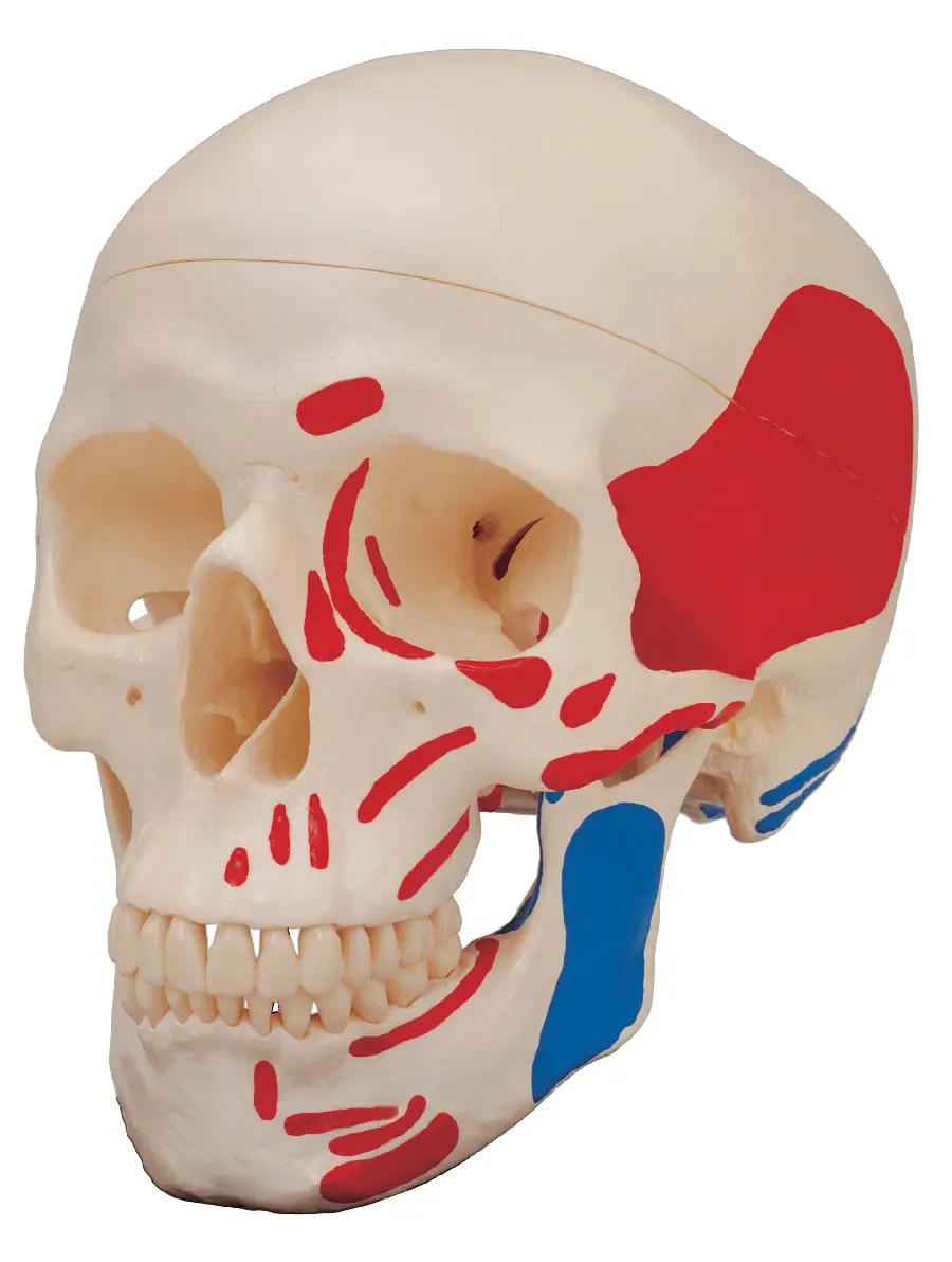 Photo of the skull